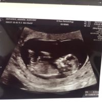 Ayuda con método ramzi: niño o niña? - 1