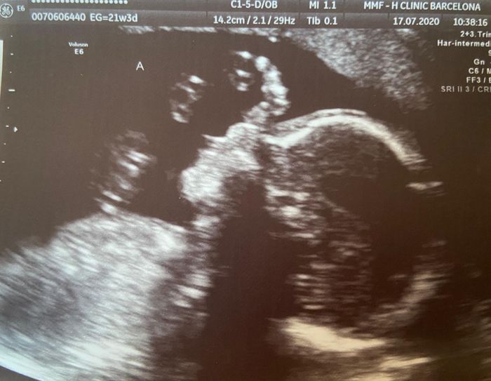 Futuras mamas noviembre 2020 - 1