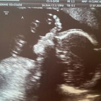 Futuras mamas noviembre 2020 - 1