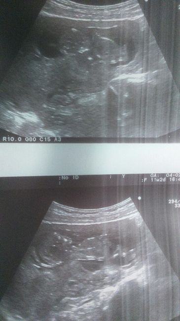 ¡¡futuras mamás agosto 2016!! - 1