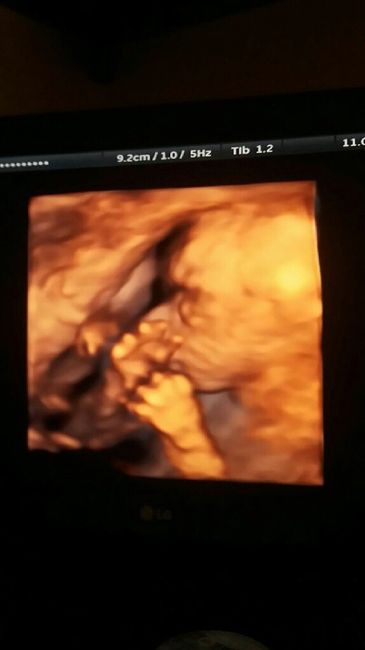 ¡¡futuras mamás agosto 2016!! - 1