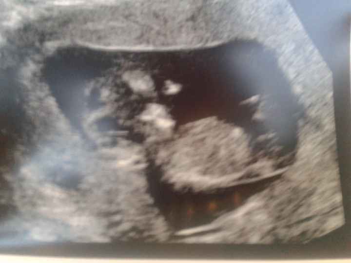 mi bebe 12 1
