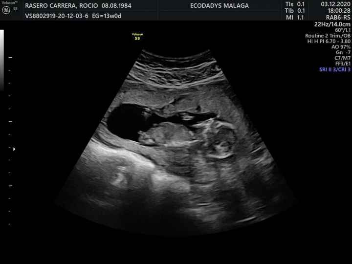 Futuras mamis junio 2021 🤰🏻❤️ oficial - 1