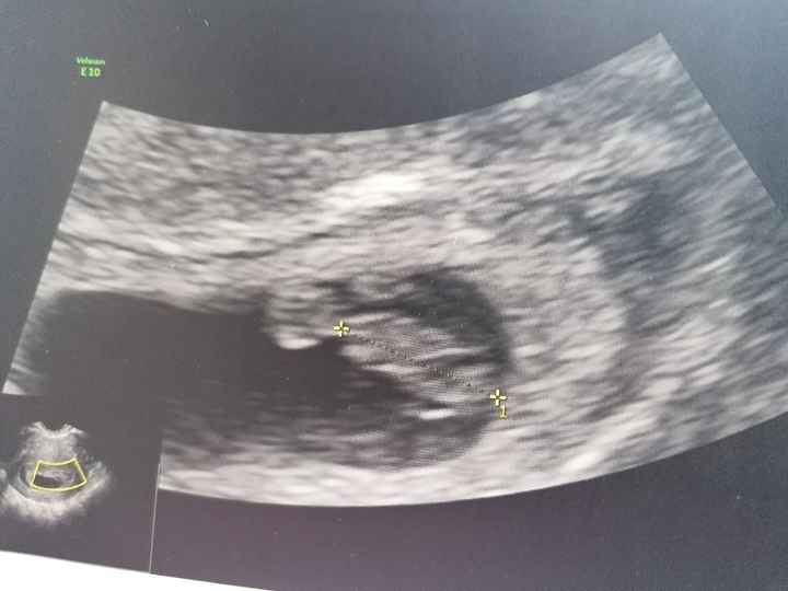 Futuras Mamis Abril 2021 - 1