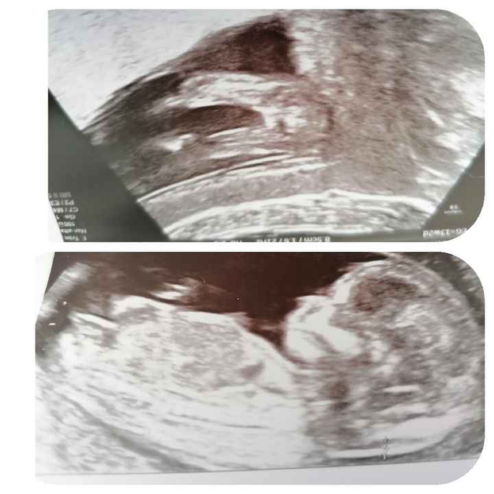 Futuras Mamis Abril 2021 - 1