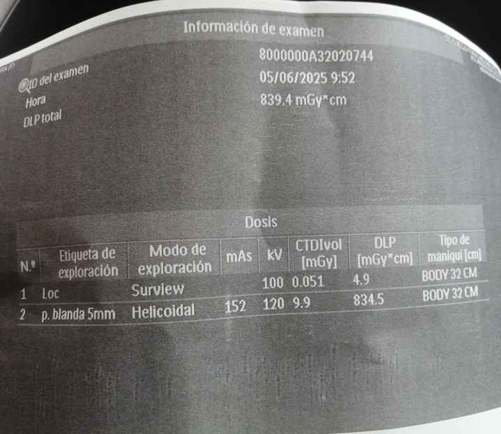 Dudas embarazo, tac pruebas medicas - 1
