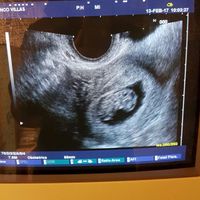 Mamis septiembre 2017 - 1