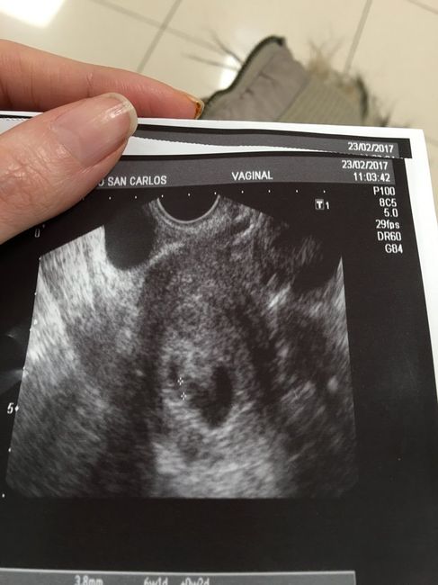 Buscadoras después de uno o varios abortos ii - 1