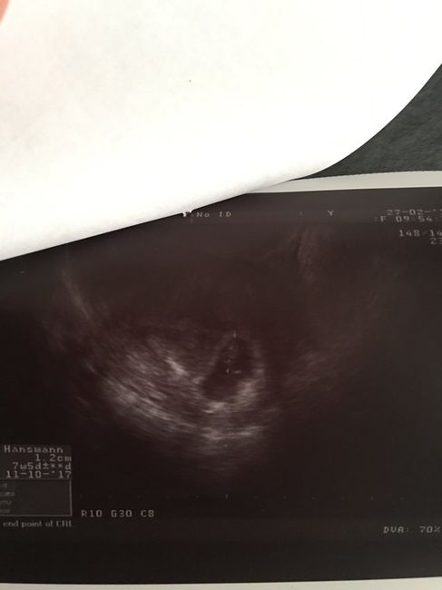 Buscadoras después de uno o varios abortos ii - 1