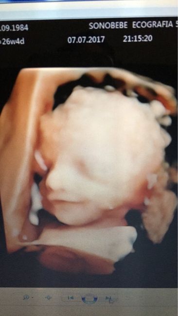 Buscadoras después de uno o varios abortos ii 1