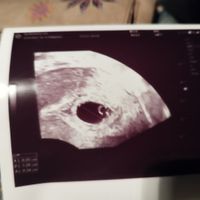 Futuras mamás julio 2023 - 1