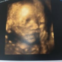 Futuras mamis diciembre 2017 - 1