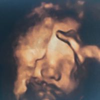 Futuras mamis diciembre 2017 - 1