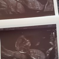 Futuras mamas noviembre 2020 - 1