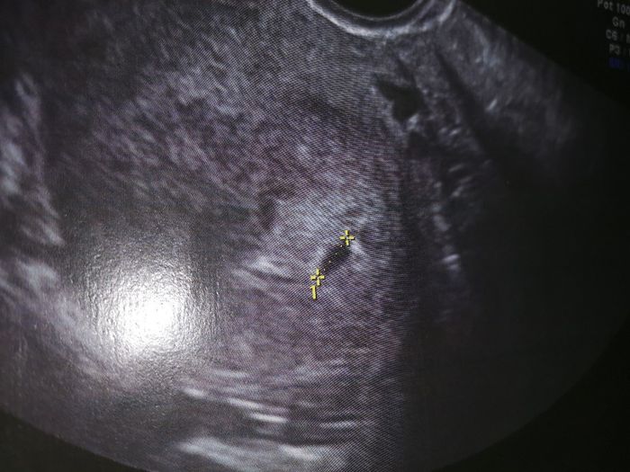 Futuras mamas Diciembre 2020 - 1