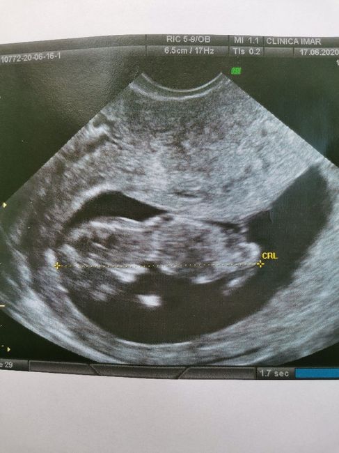 Futuras mamas Diciembre 2020 - 1