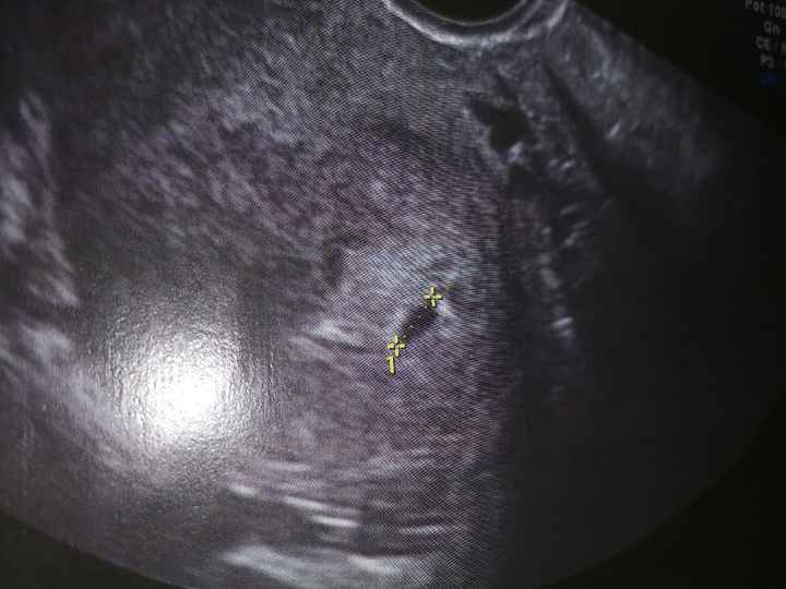 Futuras mamas Diciembre 2020 - 1