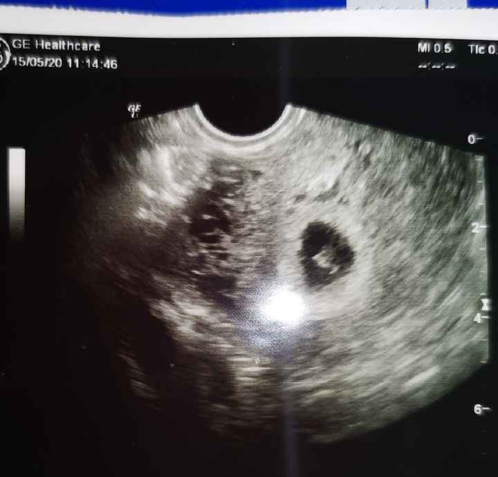Futuras Mamis Enero 2021 - 1