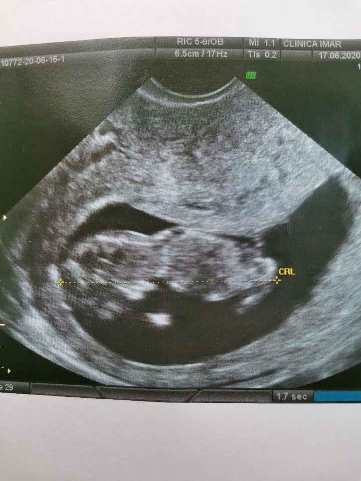 Futuras mamas Diciembre 2020 - 1