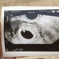 Futuras mamas noviembre 2020 - 1