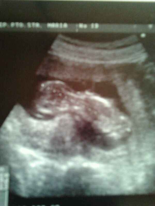 Mi bebe de 13 semanitas