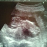 Mi bebe de 13 semanitas