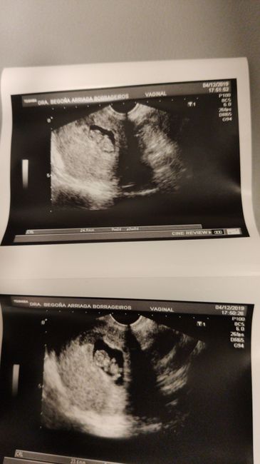 Futuras Mamas Julio 2020. - 1