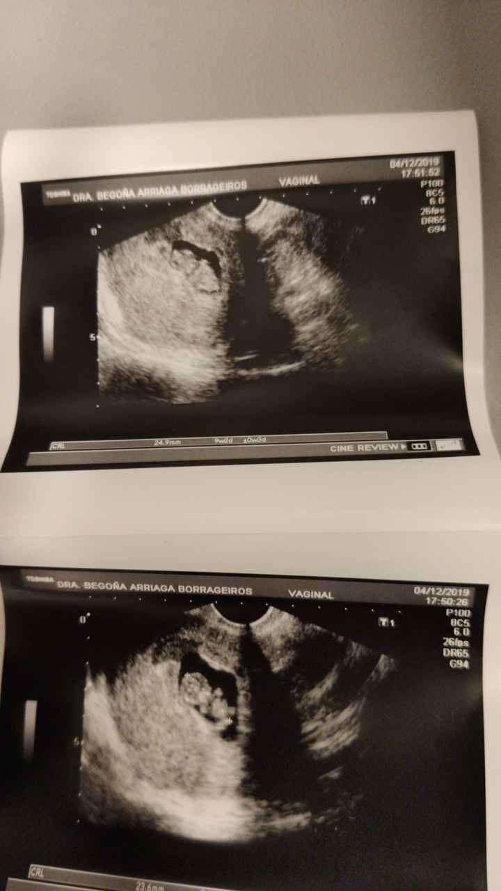 Futuras Mamas Julio 2020. - 1