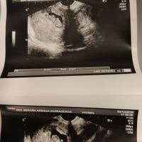 Futuras Mamas Julio 2020. - 1