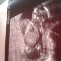 bebote 15 semanas