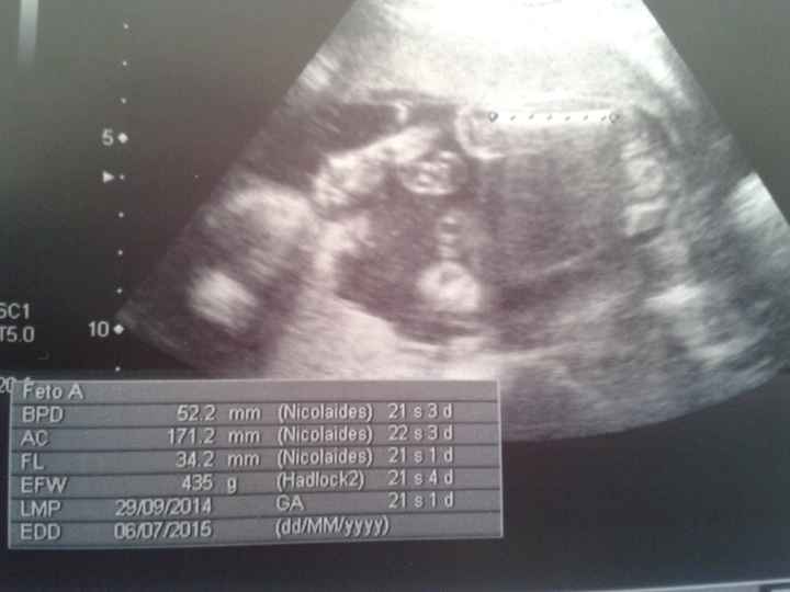 Super mamás julio 2015!! :) - 1