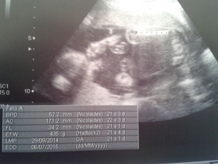 Super mamás julio 2015!! :) - 1