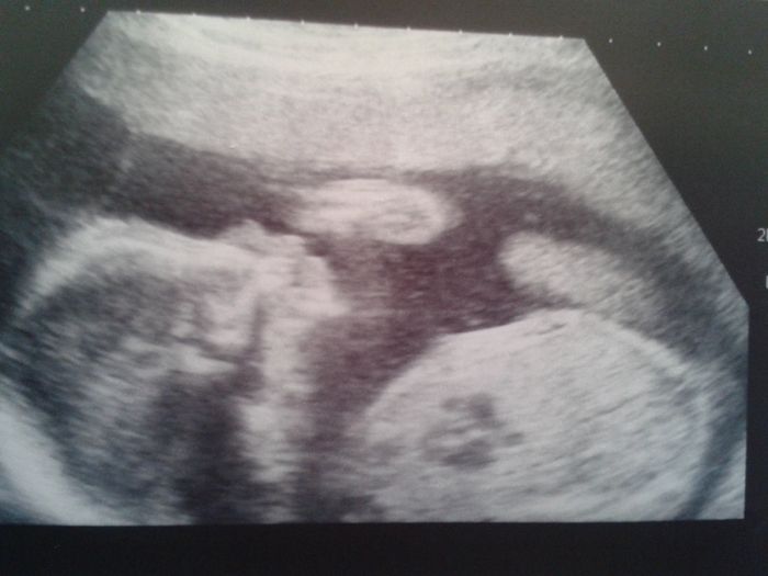 Super mamás julio 2015!! :) - 2