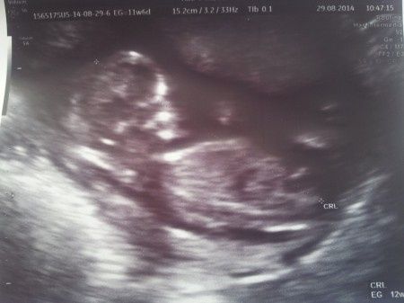 mi bebe de 12 semanas