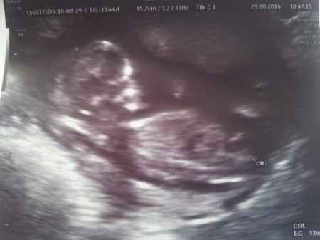 mi bebe de 12 semanas