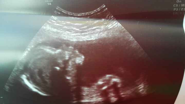 20 semanas