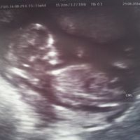 mi bebe de 12 semanas