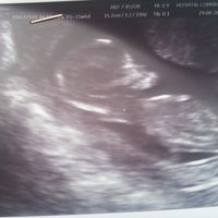 mi bebe