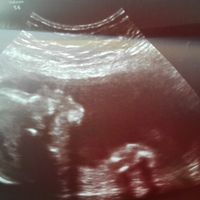 20 semanas