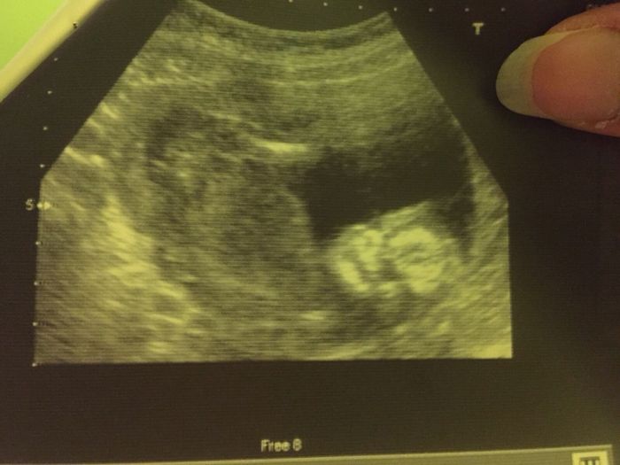 16 semanas! Parece NIÑA!!!!
