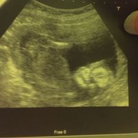 16 semanas! Parece NIÑA!!!!