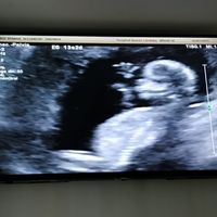 Futuras mamis Enero 2020 - 1