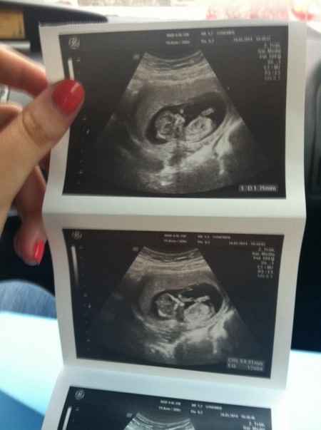 El consultorio de Lita para futuras mamis - 1