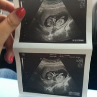 El consultorio de Lita para futuras mamis - 1