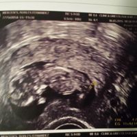 El consultorio de Lita para futuras mamis - 1