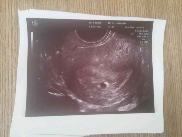 Mamis julio 2017 - 1