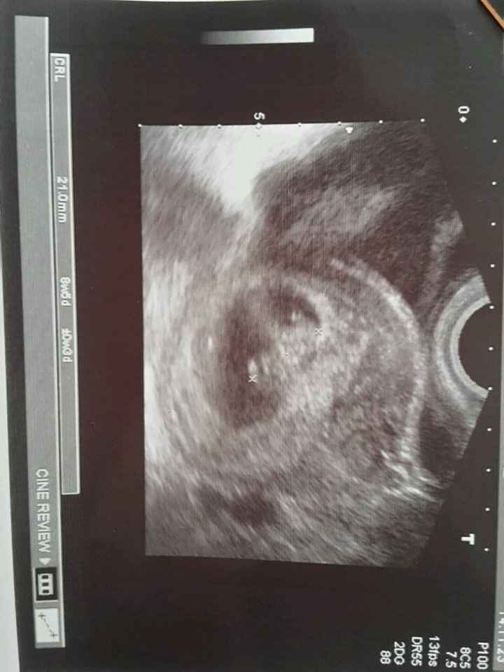 Mamis julio 2017 - 1