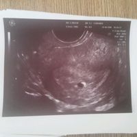 Mamis julio 2017 - 1