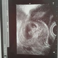 Mamis julio 2017 - 1