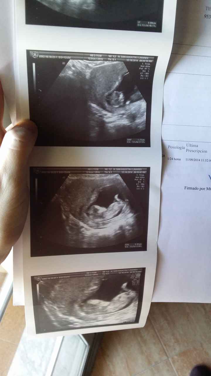 El consultorio de Lita para futuras mamis - 2